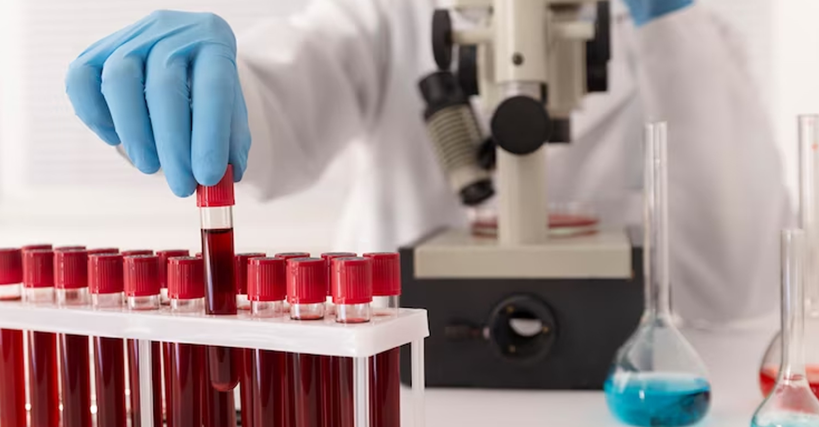 Uncovering the Mystery: Tracing the History of Hemophilia